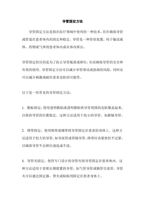 导管固定方法