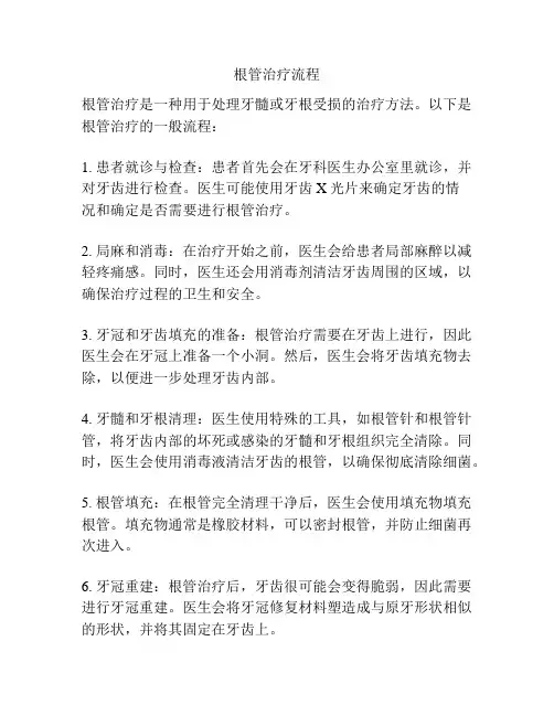 根管治疗流程