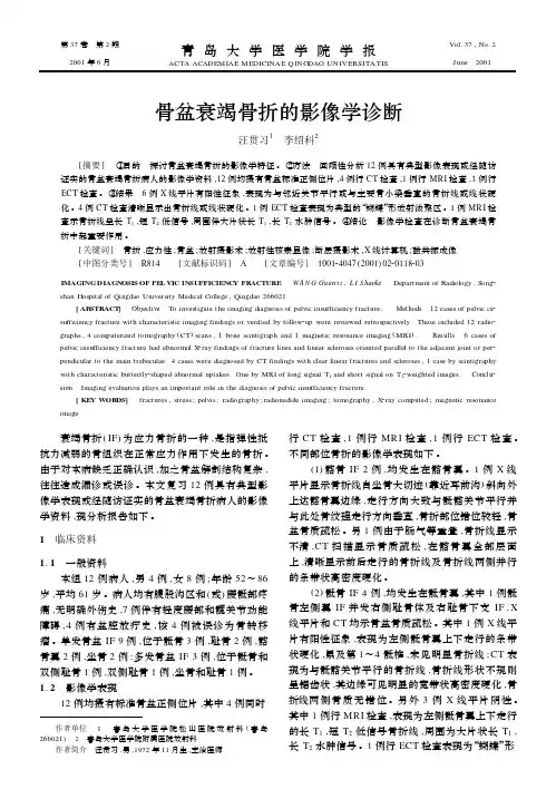 骨盆衰竭骨折的影像学诊断