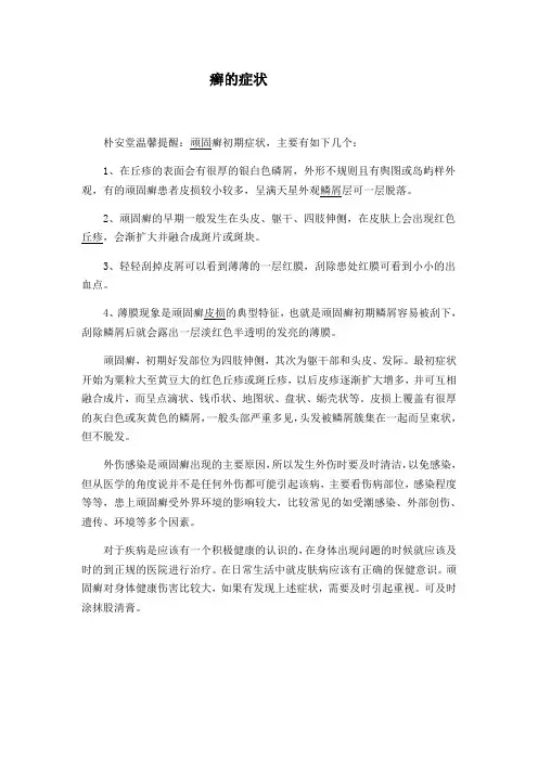 癣的症状