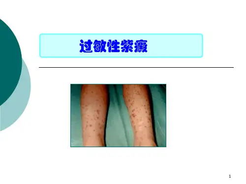 过敏性紫癜(1)PPT课件