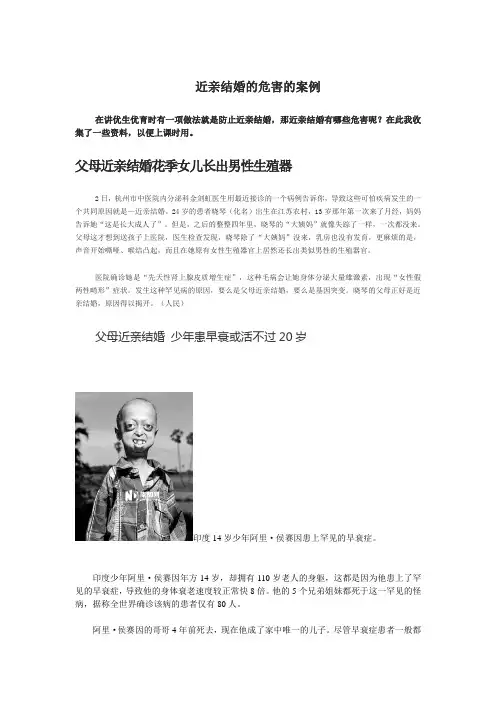 近亲结婚的危害的案例