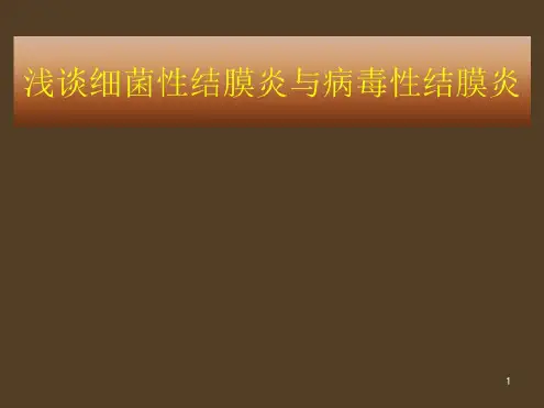 细菌性结膜炎与病毒性结膜炎的临床表现及治疗-2022年学习资料