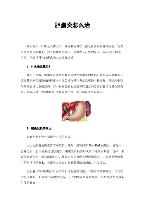 胆囊炎怎么治