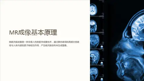 MR成像基本原理