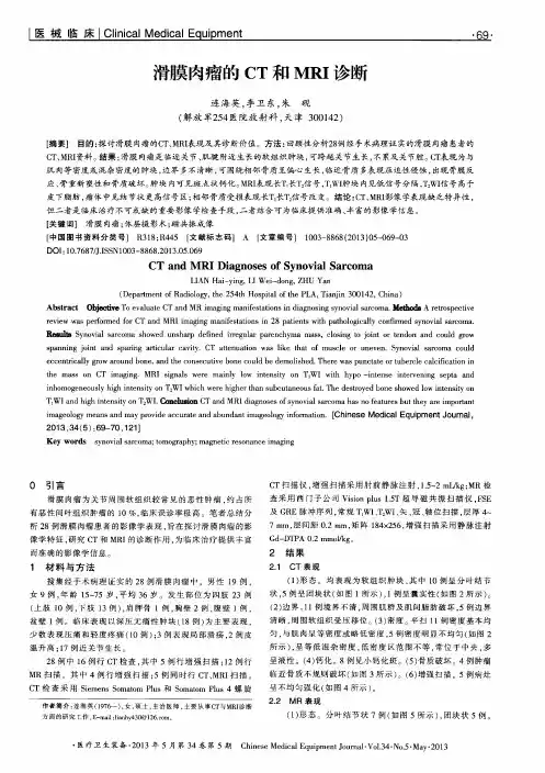 滑膜肉瘤的CT和MRI诊断