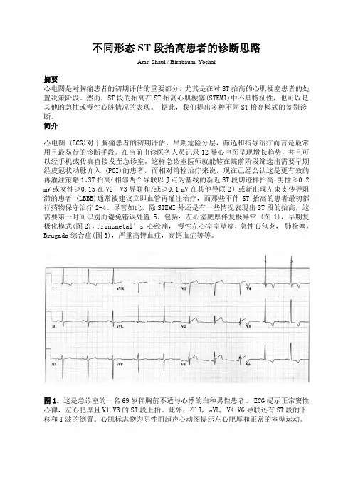不同形态ST段抬高患者的诊断思路