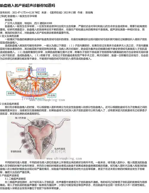 胎盘植入的产前超声诊断你知道吗