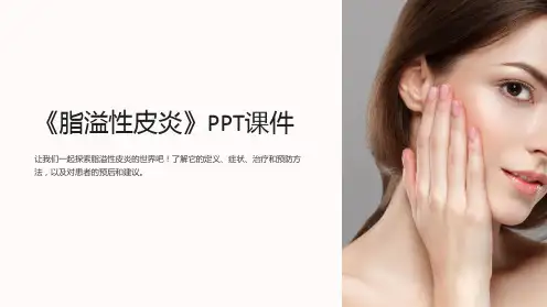 《脂溢性皮炎》课件
