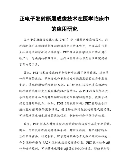 正电子发射断层成像技术在医学临床中的应用研究