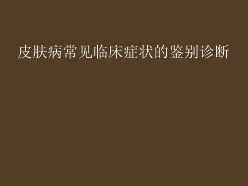 皮肤病常见临床症状的鉴别诊断