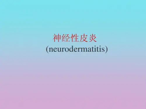 神经性皮炎 瘙痒症
