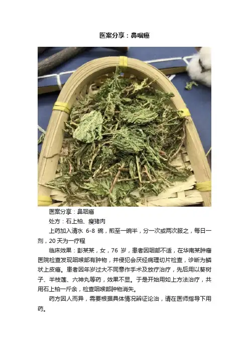 医案分享：鼻咽癌