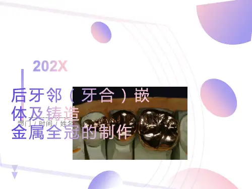 铸造金属全冠的制作