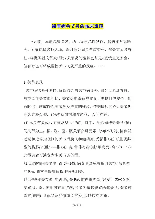 银屑病关节炎的临床表现