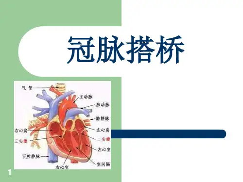 冠脉搭桥个案PPT演示课件