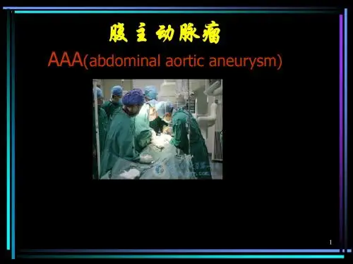 (推荐课件)腹主动脉瘤PPT课件