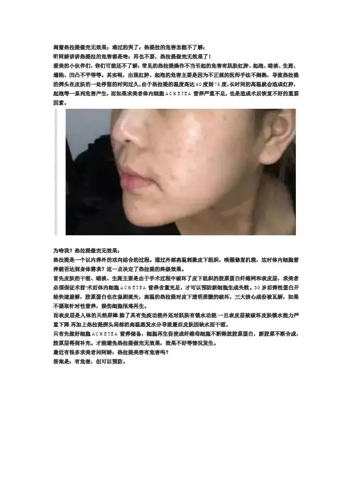 嗨体去颈纹能维持多久？嗨体去颈纹要多久打一次？