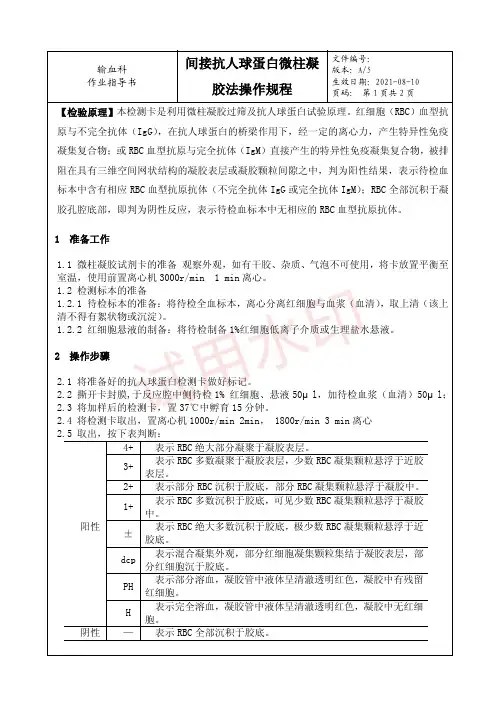 16 间接抗人球蛋白微柱凝胶法操作规程---作业指导书