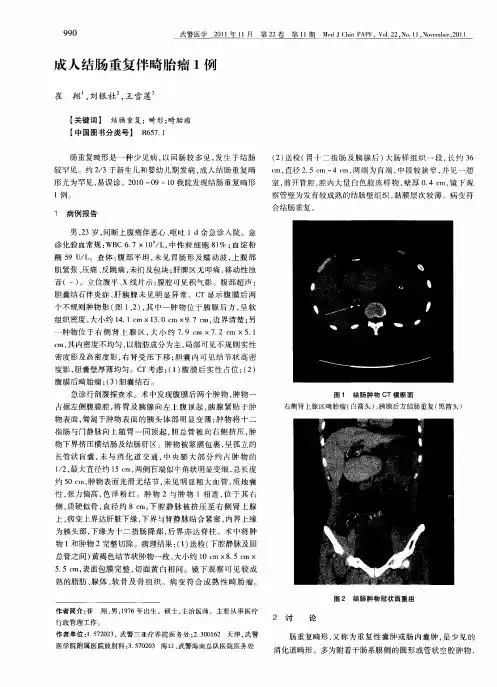 成人结肠重复伴畸胎瘤1例