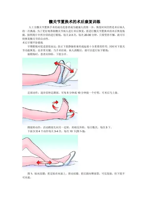 髋关节置换术体疗操