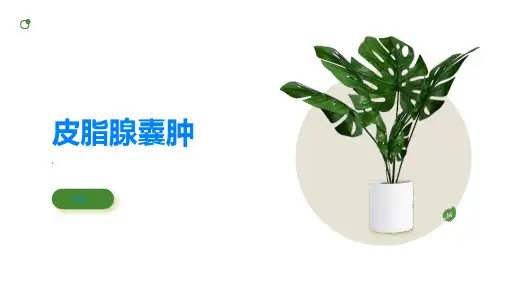 皮脂腺囊肿了解它才能更好应对