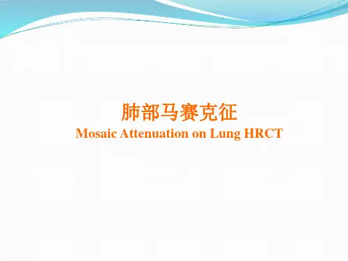 马赛克征表现