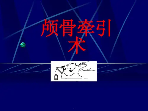 颅骨牵引术ppt课件