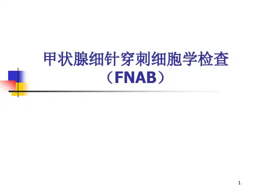 (精选课件)甲状腺细针穿刺细胞学检查终稿