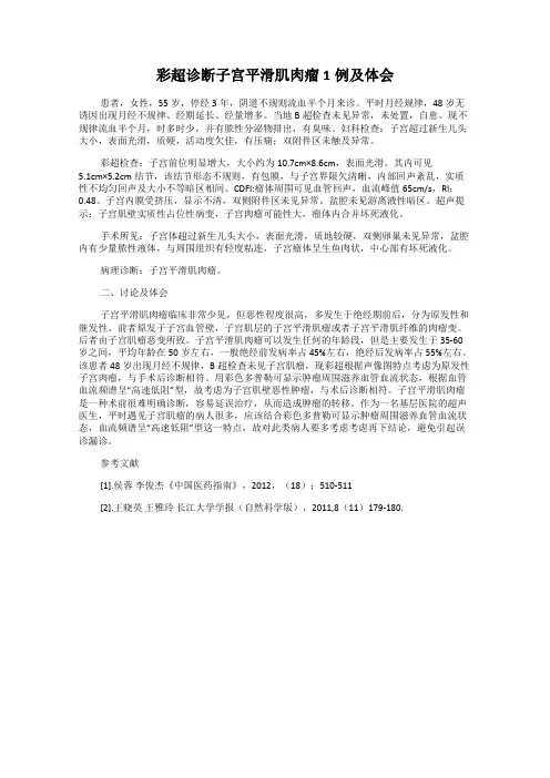 彩超诊断子宫平滑肌肉瘤1例及体会
