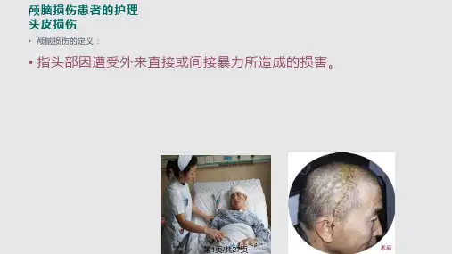 头皮损伤PPT课件
