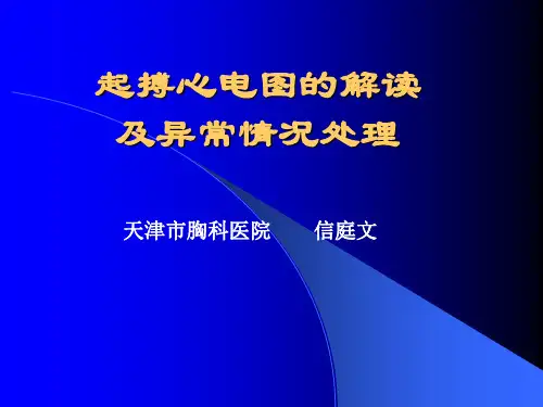 起搏心电图的解读及异常PPT