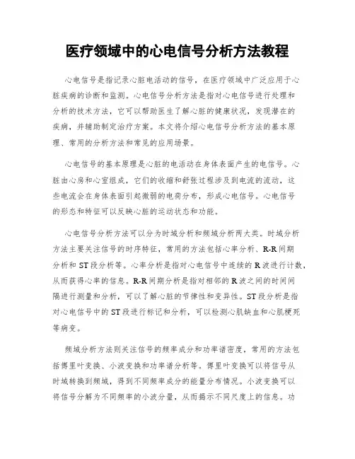 医疗领域中的心电信号分析方法教程