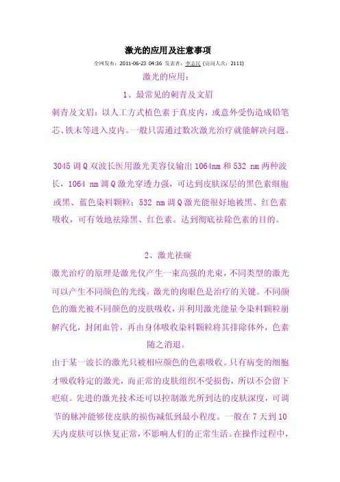 调Q激光——精选推荐