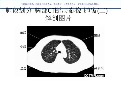 胸部CT肺段划分课件