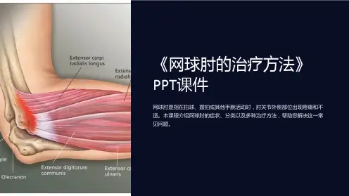 《网球肘的治疗方法》课件