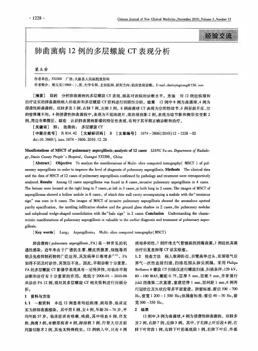 肺曲菌病12例的多层螺旋CT表现分析