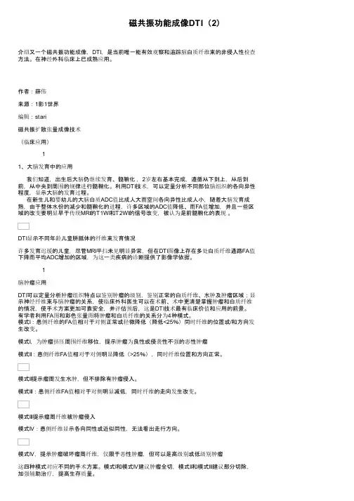 磁共振功能成像DTI（2）