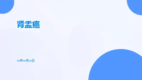 (医学课件)肾盂癌