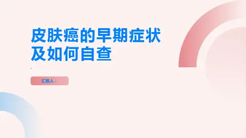 皮肤癌的早期症状及如何自查