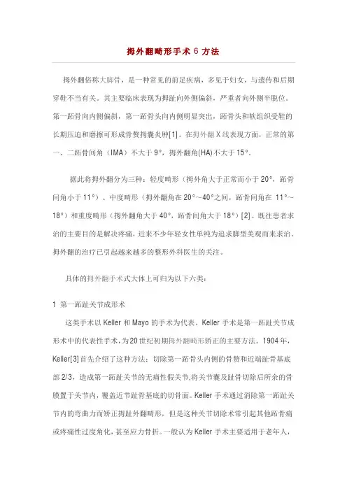 拇外翻畸形手术6方法