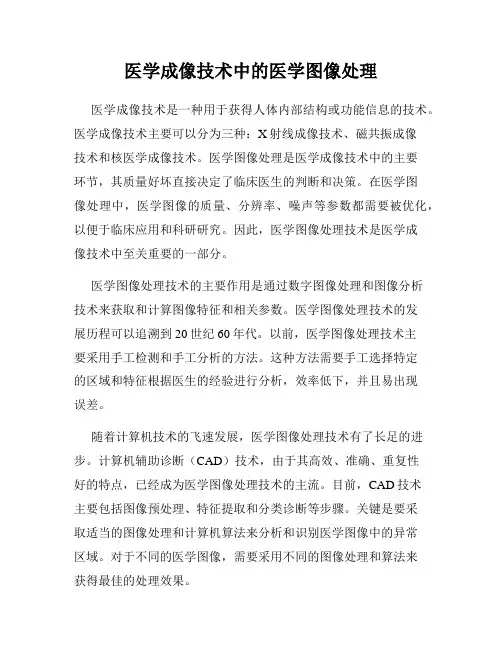 医学成像技术中的医学图像处理