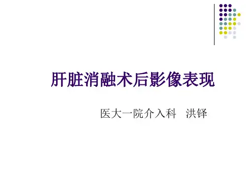 肝脏消融术后影像汇总.