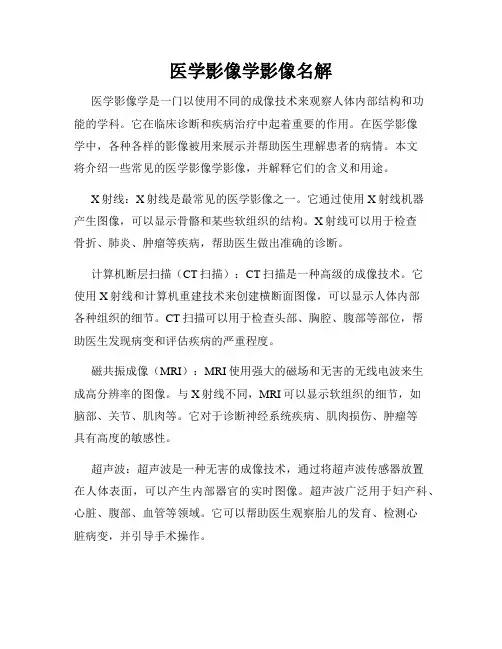 医学影像学影像名解