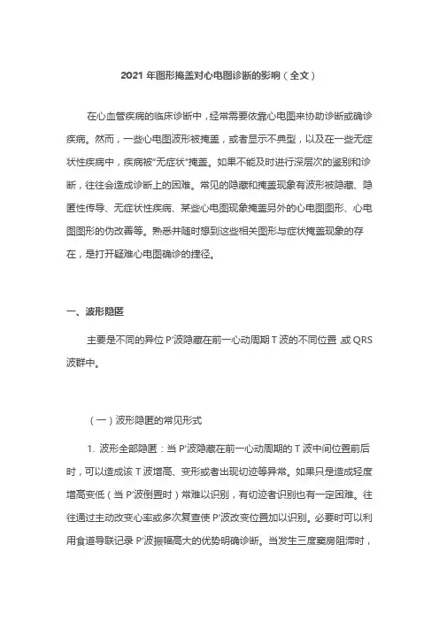 2021年图形掩盖对心电图诊断的影响(全文)