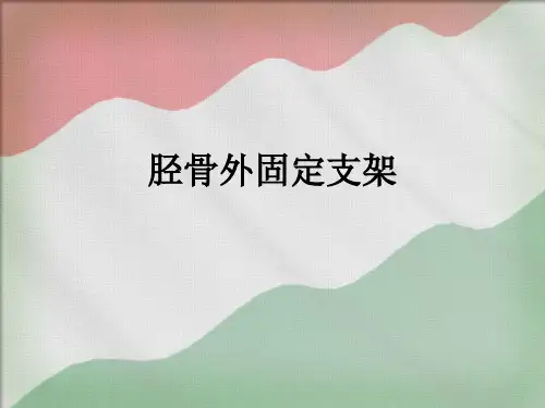 胫骨外固定支架ppt课件