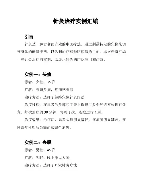 针灸治疗实例汇编