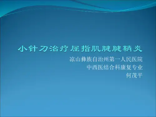 小针刀治疗屈指肌腱腱鞘炎