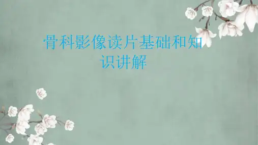 骨科影像读片基础和知识讲解课件
