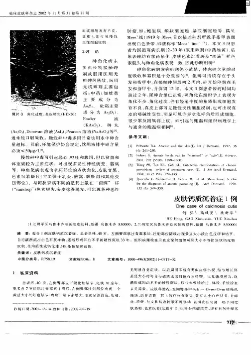 皮肤钙质沉着症1例